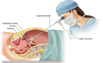 9801066102 - Sharda Women Hospital in Patna is a leading center for Gynaecology, Maternity, and women’s health care. Led by Dr. Khushbu Tewary, the hospital offers expert treatment in pregnancy, infertility, and laparoscopic surgery. With modern facilities and compassionate care, it’s a trusted choice for women across Patna,Sharda Women Hospital is dedicated to wellbeing of Women. All kinds of services available such as 24 hours emergency delivery and caeserian facility, all kinds of gynaecological and general surgery cases done here. Latest techniques such as laparoscopy and hysteroscopy done here best gynecologist hospital in patna, gynecologist hospital in patna, gynecologist in patna, top 5 gynecologist hospital in patna, top 10 gynecologist hospital in patna, best gynecology hospital in patna, gynecology hospital in patna, gynecology in patna, top 5 gynecology hospital in patna, gynaecologist in patna, top 5 gynaecologist in patna, best gynaecologist hospital in patna, gynaecologist hospital in patna, gynaecologist in patna near me,Best gynaecologist in patna, gynaecologist near me, gynaecologist in rukanpura patna, top 3 gynaecologist in patna, top 10 lady doctor in patna. top lady doctor in patna, ladies specialist doctor in patna, best hospital for normal delivery in patna, best maternity hospital in patna, general physician in patna. Best gynaecologist in patna, Best gynecologist in patna.