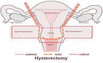 9801066102 - Sharda Women Hospital in Patna is a leading center for Gynaecology, Maternity, and women’s health care. Led by Dr. Khushbu Tewary, the hospital offers expert treatment in pregnancy, infertility, and laparoscopic surgery. With modern facilities and compassionate care, it’s a trusted choice for women across Patna,Sharda Women Hospital is dedicated to wellbeing of Women. All kinds of services available such as 24 hours emergency delivery and caeserian facility, all kinds of gynaecological and general surgery cases done here. Latest techniques such as laparoscopy and hysteroscopy done here best gynecologist hospital in patna, gynecologist hospital in patna, gynecologist in patna, top 5 gynecologist hospital in patna, top 10 gynecologist hospital in patna, best gynecology hospital in patna, gynecology hospital in patna, gynecology in patna, top 5 gynecology hospital in patna, gynaecologist in patna, top 5 gynaecologist in patna, best gynaecologist hospital in patna, gynaecologist hospital in patna, gynaecologist in patna near me,Best gynaecologist in patna, gynaecologist near me, gynaecologist in rukanpura patna, top 3 gynaecologist in patna, top 10 lady doctor in patna. top lady doctor in patna, ladies specialist doctor in patna, best hospital for normal delivery in patna, best maternity hospital in patna, general physician in patna. Best gynaecologist in patna, Best gynecologist in patna.